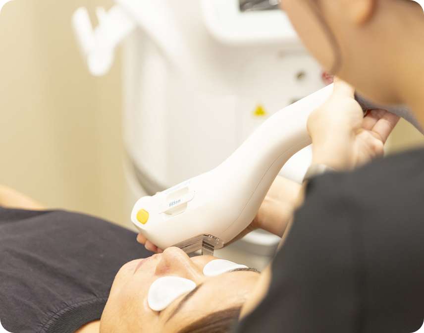 フォトフェイシャル ステラM22